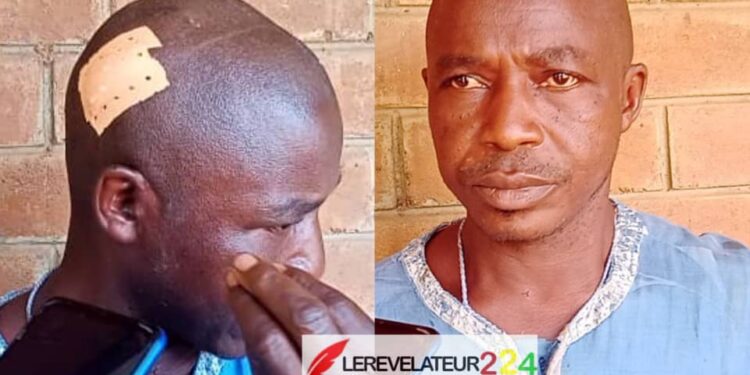 KINDIA : Un mort et des blessés graves dans un conflit domanial…