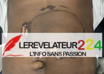 Conakry: Accusé par son patron d&rsquo;avoir volé 100 000 dollars, Thierno Ousmane victime d&rsquo;une torture atroce