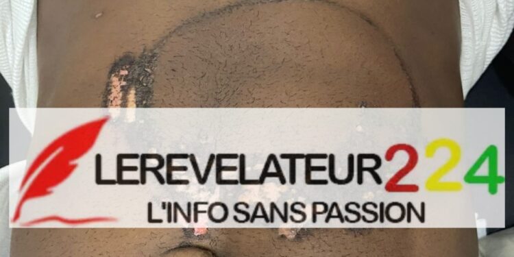 Conakry: Accusé par son patron d&rsquo;avoir volé 100 000 dollars, Thierno Ousmane victime d&rsquo;une torture atroce