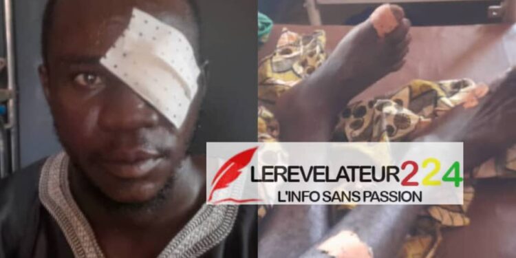 SIGUIRI: Un conflit domanial entre habitants de kofilani et tomboni fait des blessés par balles