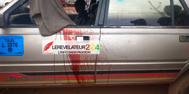 Route nationale Conakry-Labé: Un chauffeur blessé par balle à Dalaba