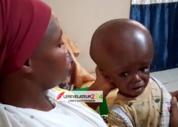 KANKAN: SOS pour Ibrahima, qui souffre d&rsquo;une hydrocéphalie…