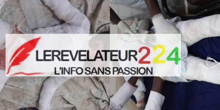 KINTINIA: Les victimes rescapées de l’incendie sont toutes décédées