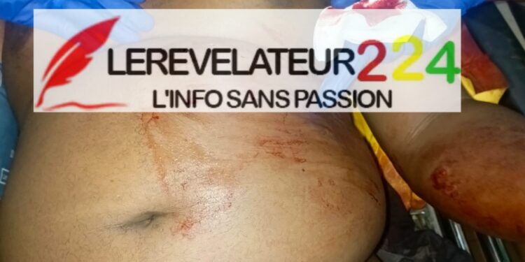 SIGUIRI: Des bandits armés attaquent un conducteur de moto-taxi