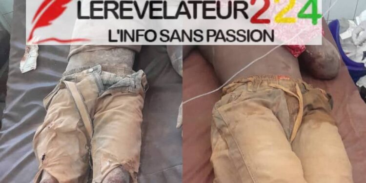 SIGUIRI : Un éboulement fait plusieurs victimes dans une mine d’or à Kintinia