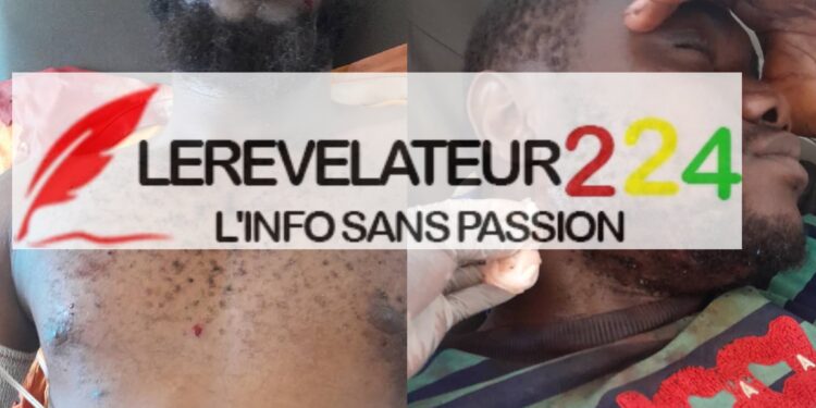 Affrontement entre jeunes de Doko et de Tatakourou : Plusieurs victimes signalées…