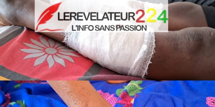 Insécurité à Labé : deux personnes blessées par balles lors d’une attaque nocturne à Tata 2
